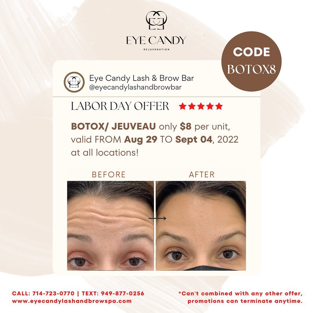 💉 LABOR DAY BOTOX/ JEUVEAU FLASH SALE! 💥
Botox/ Jeuveau for only $8 per unit. Let's smooth your wrinkles😉

CALL/ TEXT us and mention the &quot;PROMO CODE&quot; when booking to get the deal!
Limited availability spots from Aug 29 to Sept 04, 2022! 
