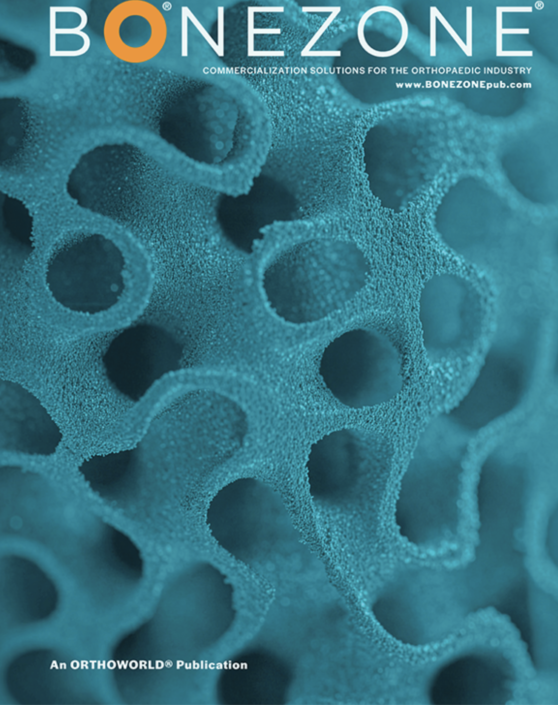 3D-Printed Femur Provides Hope for Improved Bone Repair BONEZONE 2025