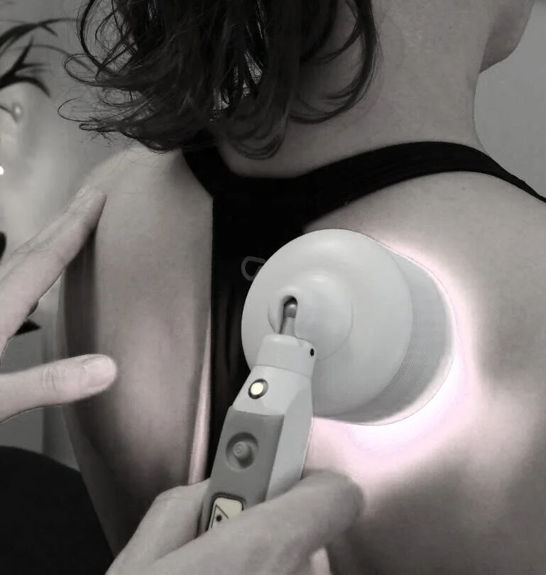 A black-and-white photograph showing a handheld laser therapy device being applied to a person’s shoulder and upper arm. The device is positioned directly against the skin, with a practitioner’s hands visible holding and guiding it.