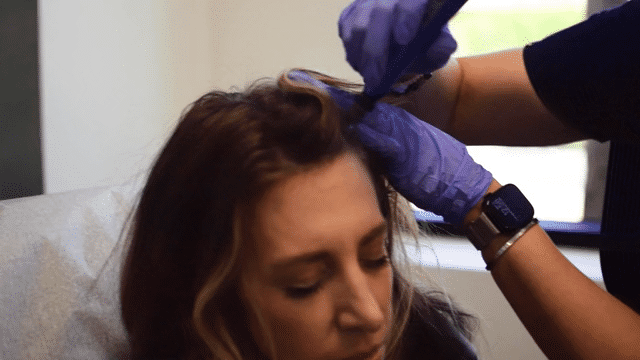 Michelle Micro Needling Web-low.gif