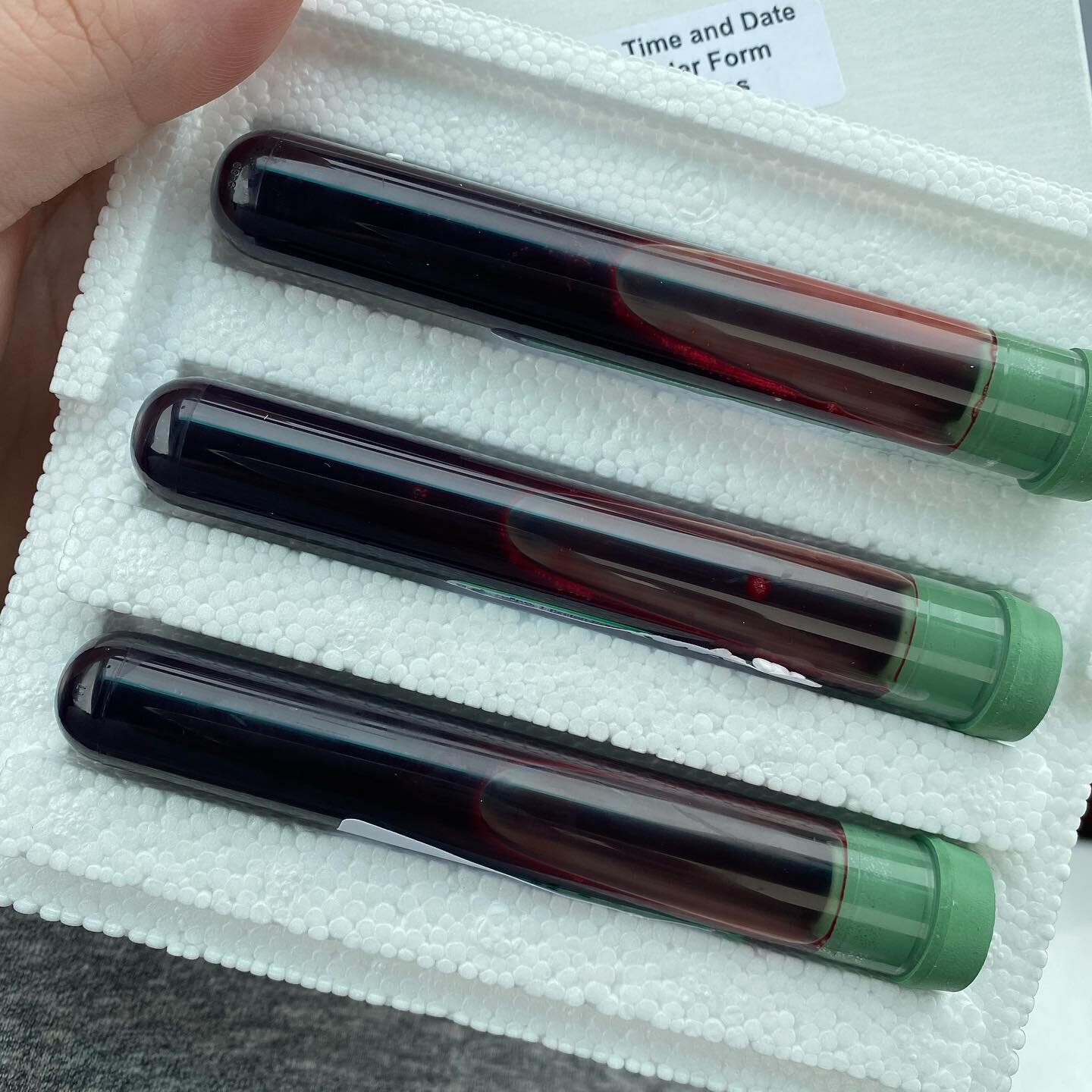 If someone told me that I would one day carry vials of my blood from the hospital to the post office, I probably would have passed out.

It&rsquo;s amazing the things we do to have our babies. 

Back story: I have passed out before while giving blood