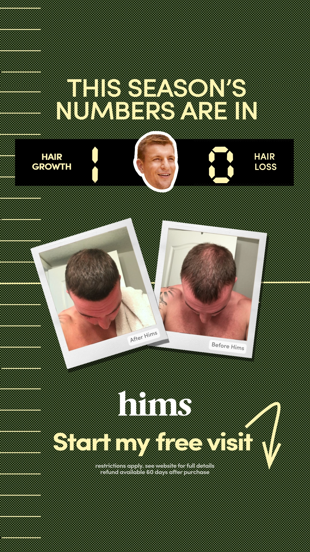 Gronk-BeforeAfter.mp4.00_00_06_20.Still001.png