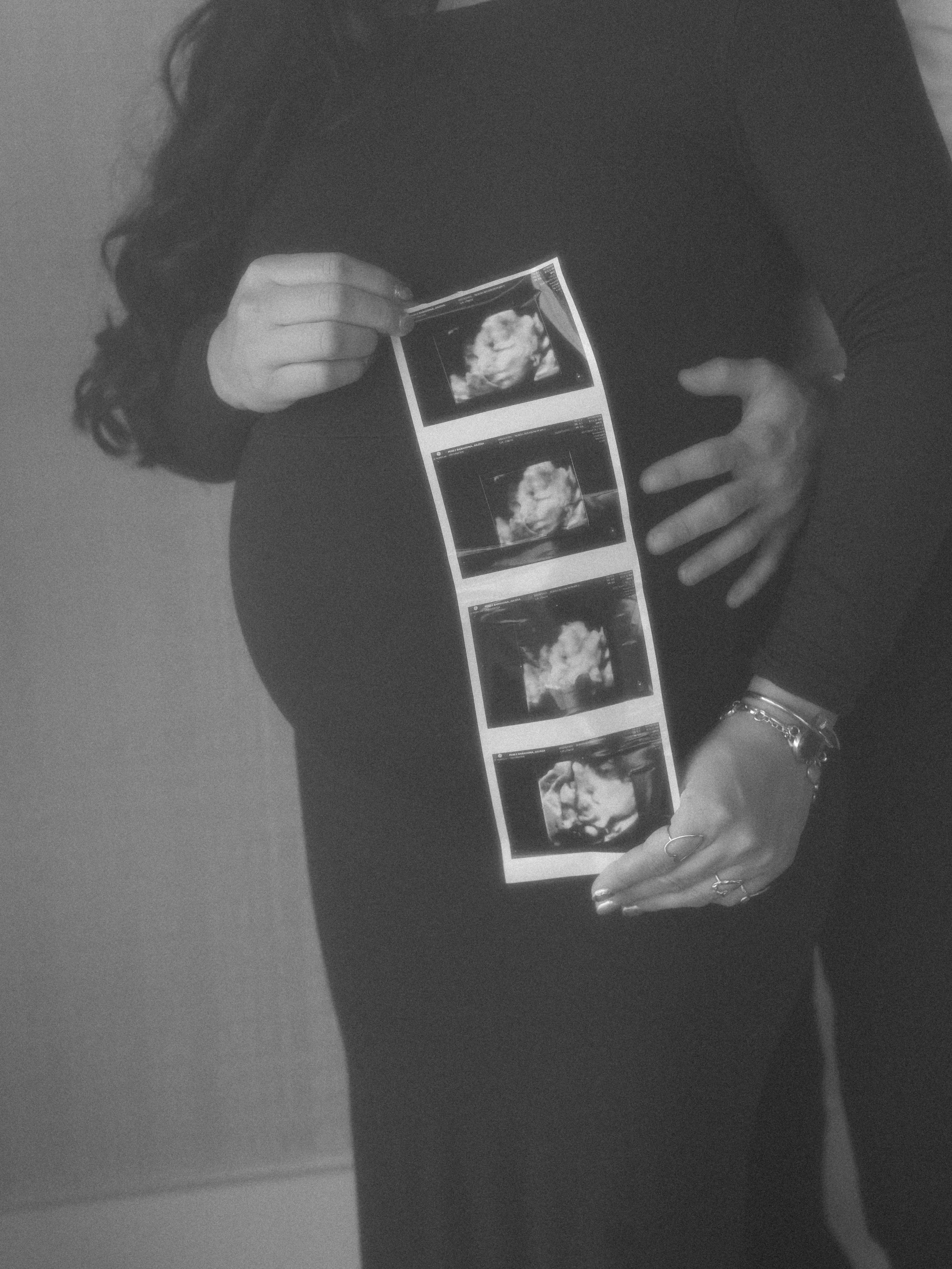 A person in a black long-sleeve shirt is holding a strip of ultrasound images, showing a developing fetus, against their abdomen.