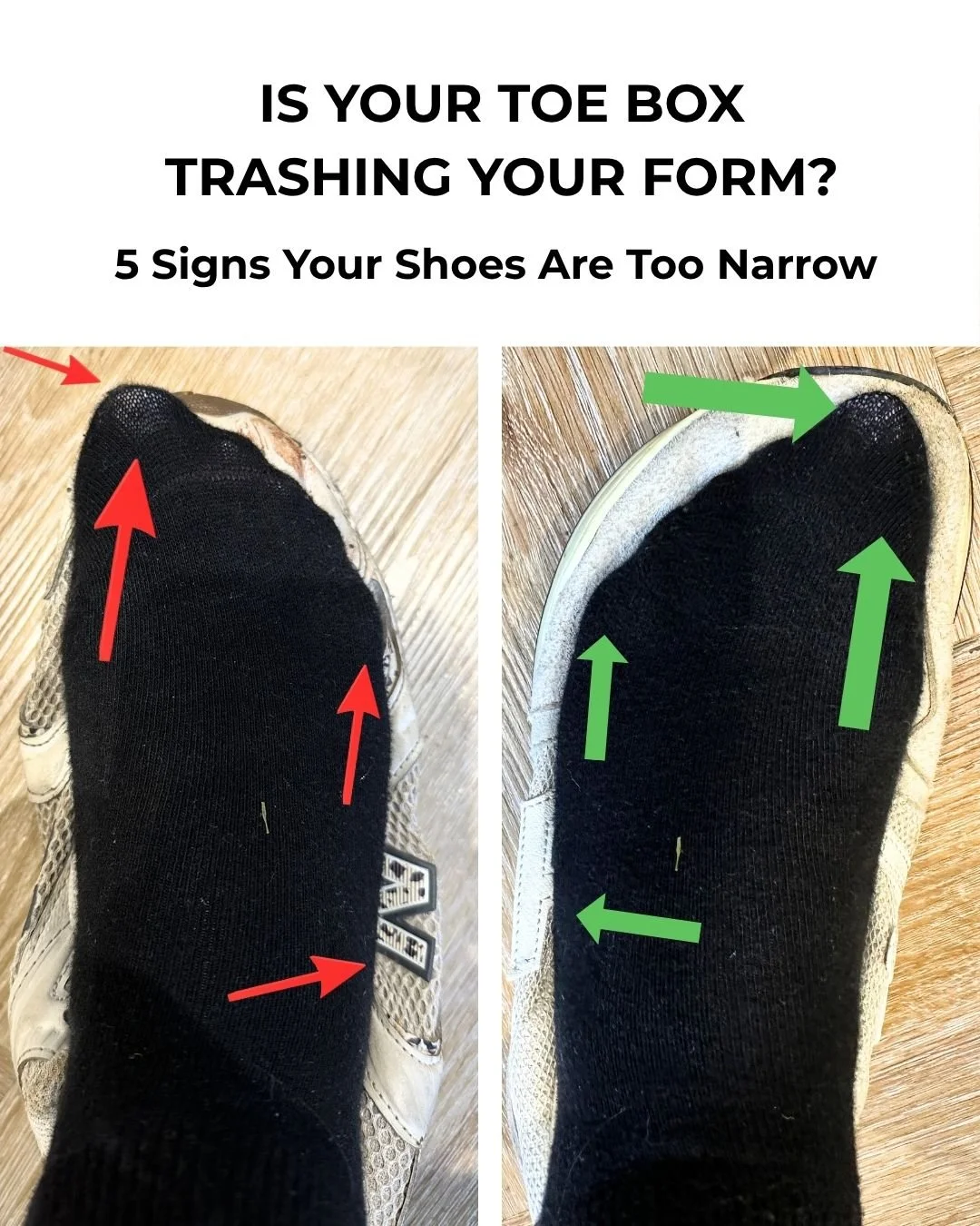 Is Your Toe Box Trashing Your Form? 5 Signs Your Shoes Are Too Narrow
