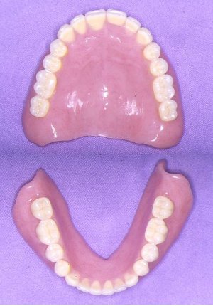 Full denture case
