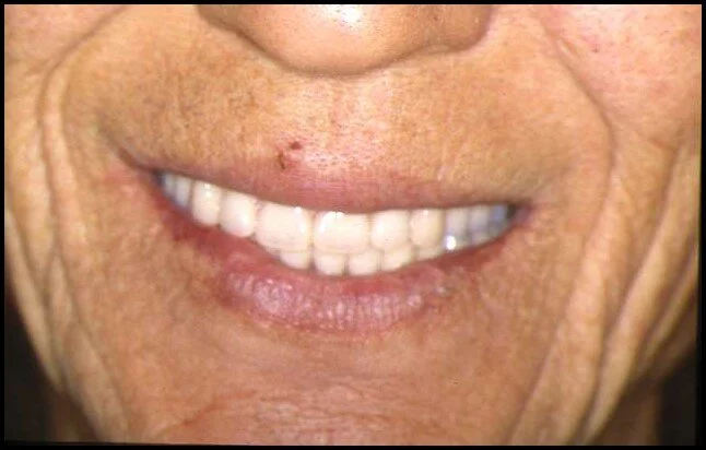 Smile confidently again!