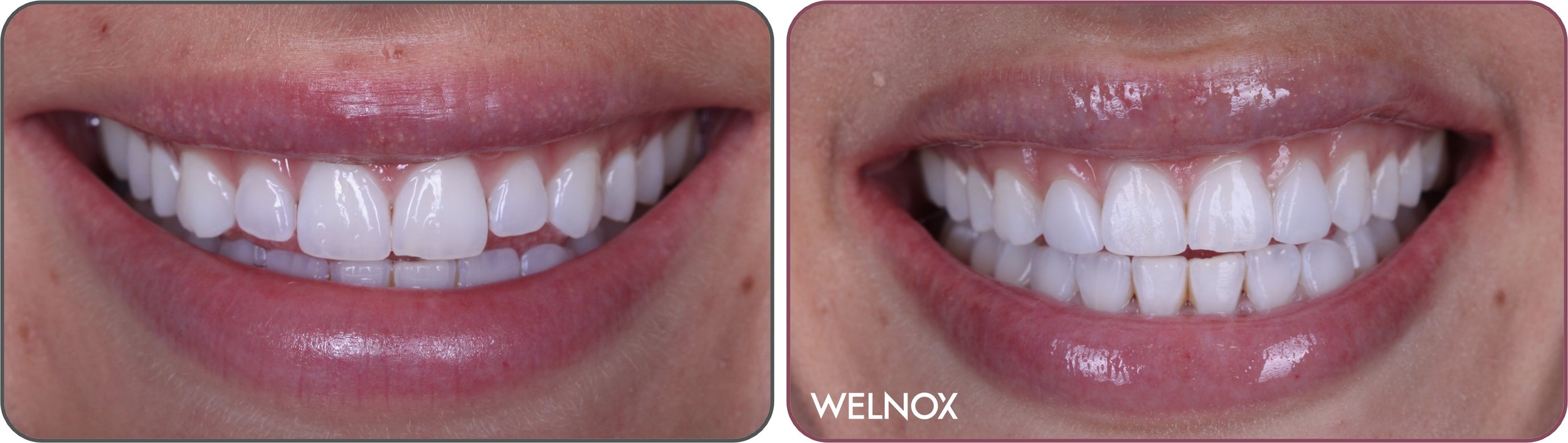 Cosmetic Dentistry, Botox & Wellness Philadelphia Center City