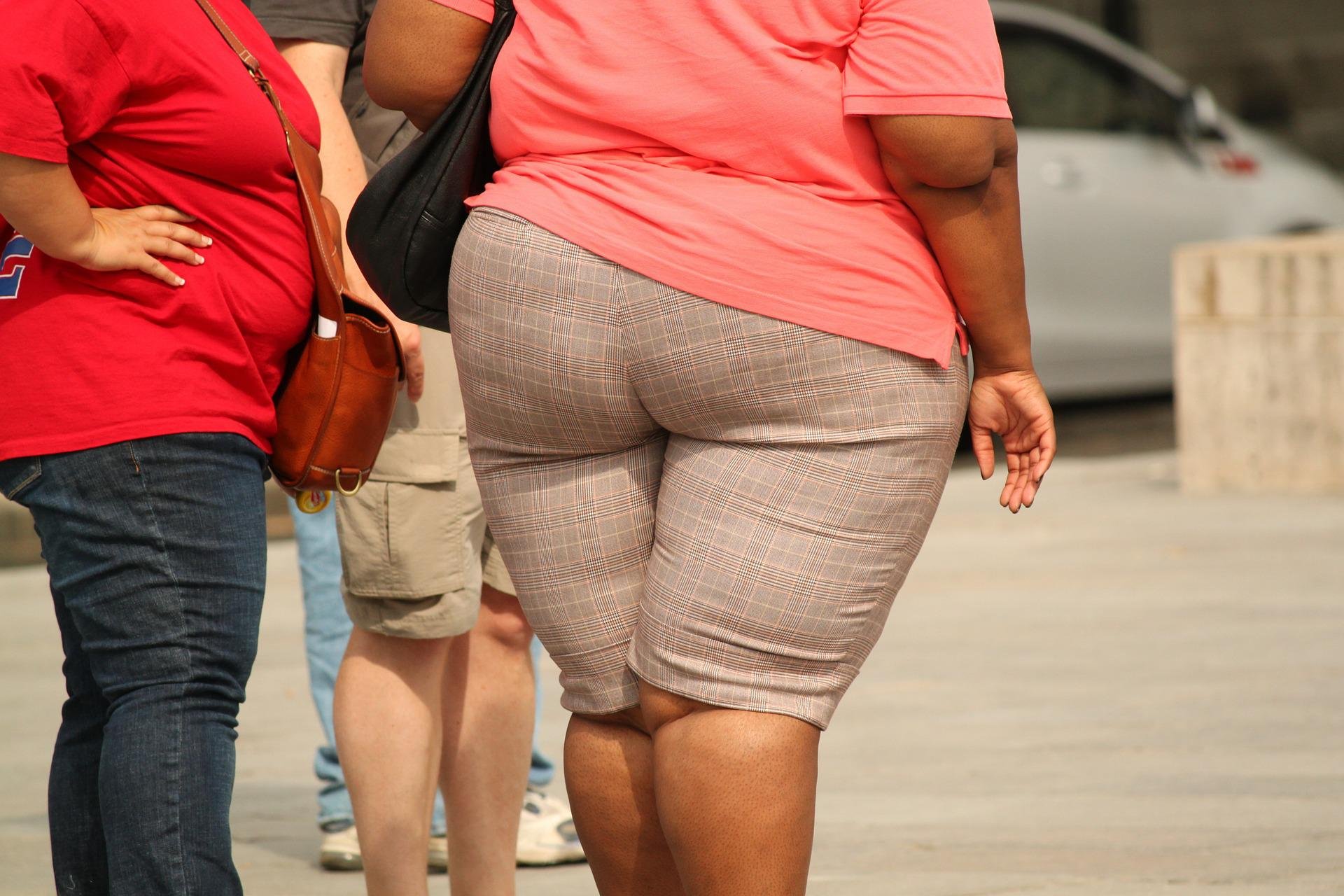 The stark reality of obesity on our doorstep