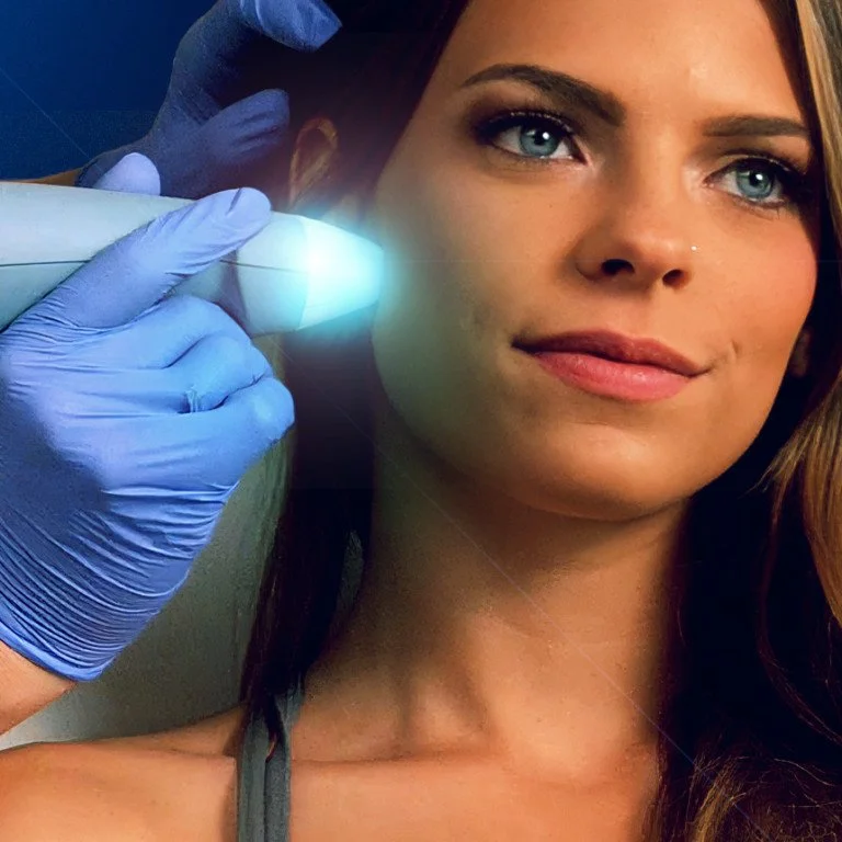 Exion Face needle-free RF and ultrasound treatment at Reviving Wellness, Cape Girardeau