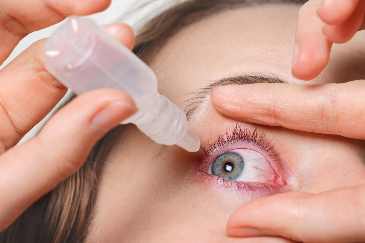 How To Know If You Have Dry Eyes Caring For Dry Eyes — Shanbom Eye
