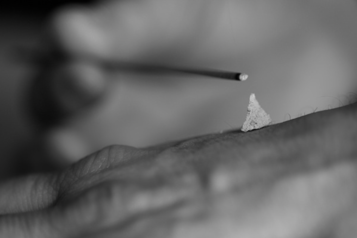 Bob Weisbord, M.ac., L.ac., Acupuncturist