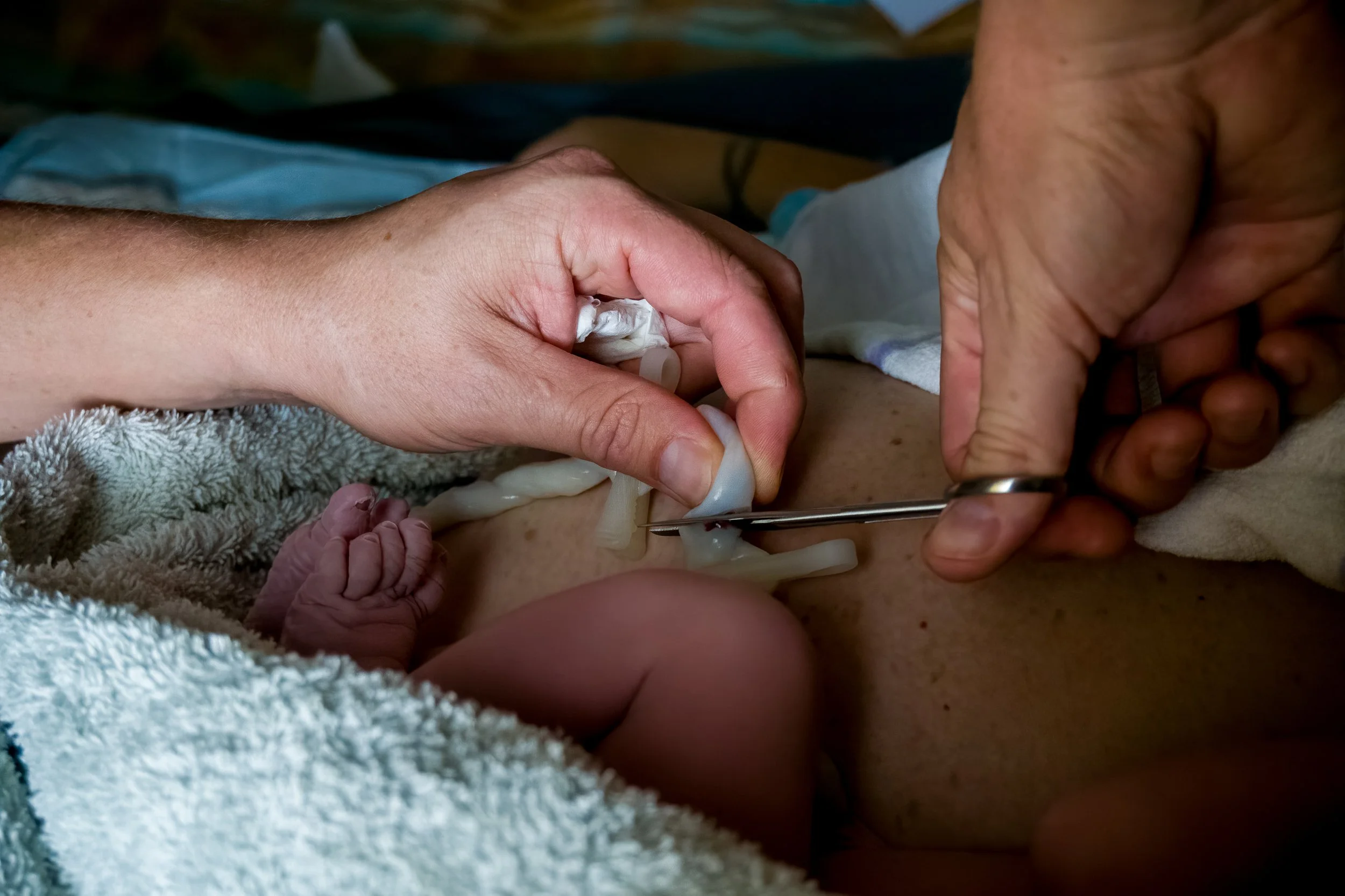 Cutting a newborn's umbilical cord with scissors, close-up.