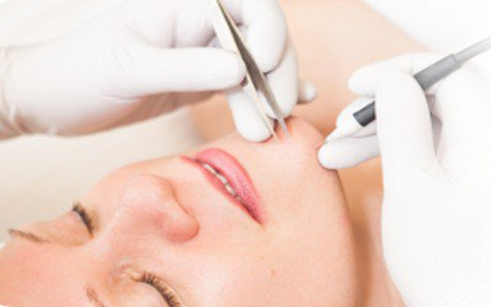 Electrolysis2.jpg
