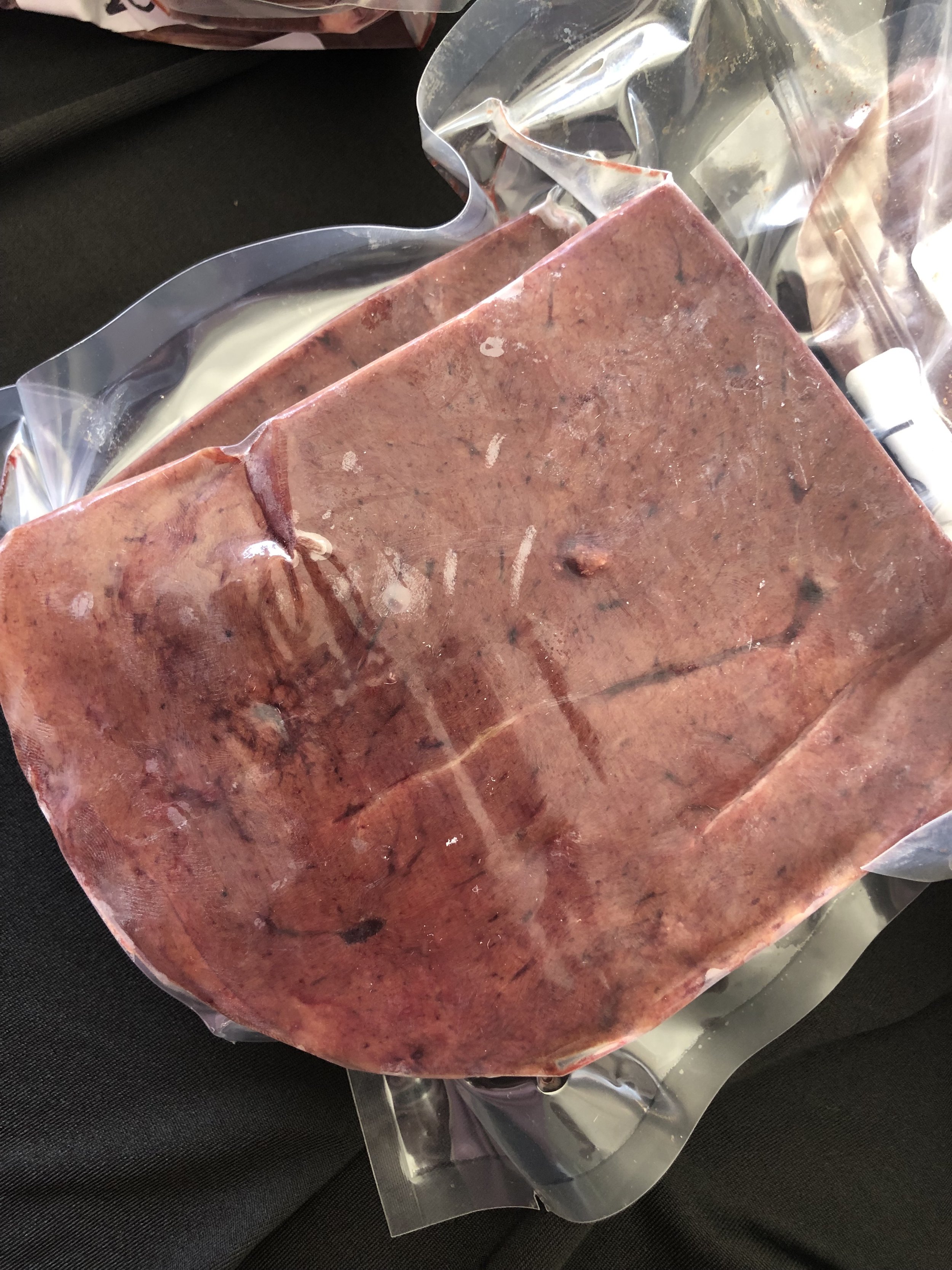 liver.jpg