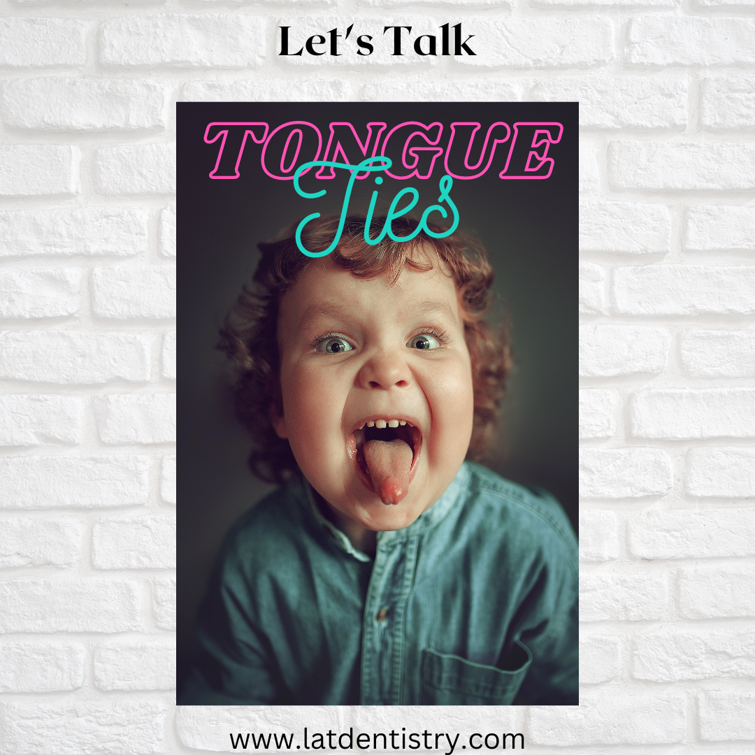 Tongue Ties – What’s The Deal?