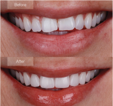 Smile Esthetics