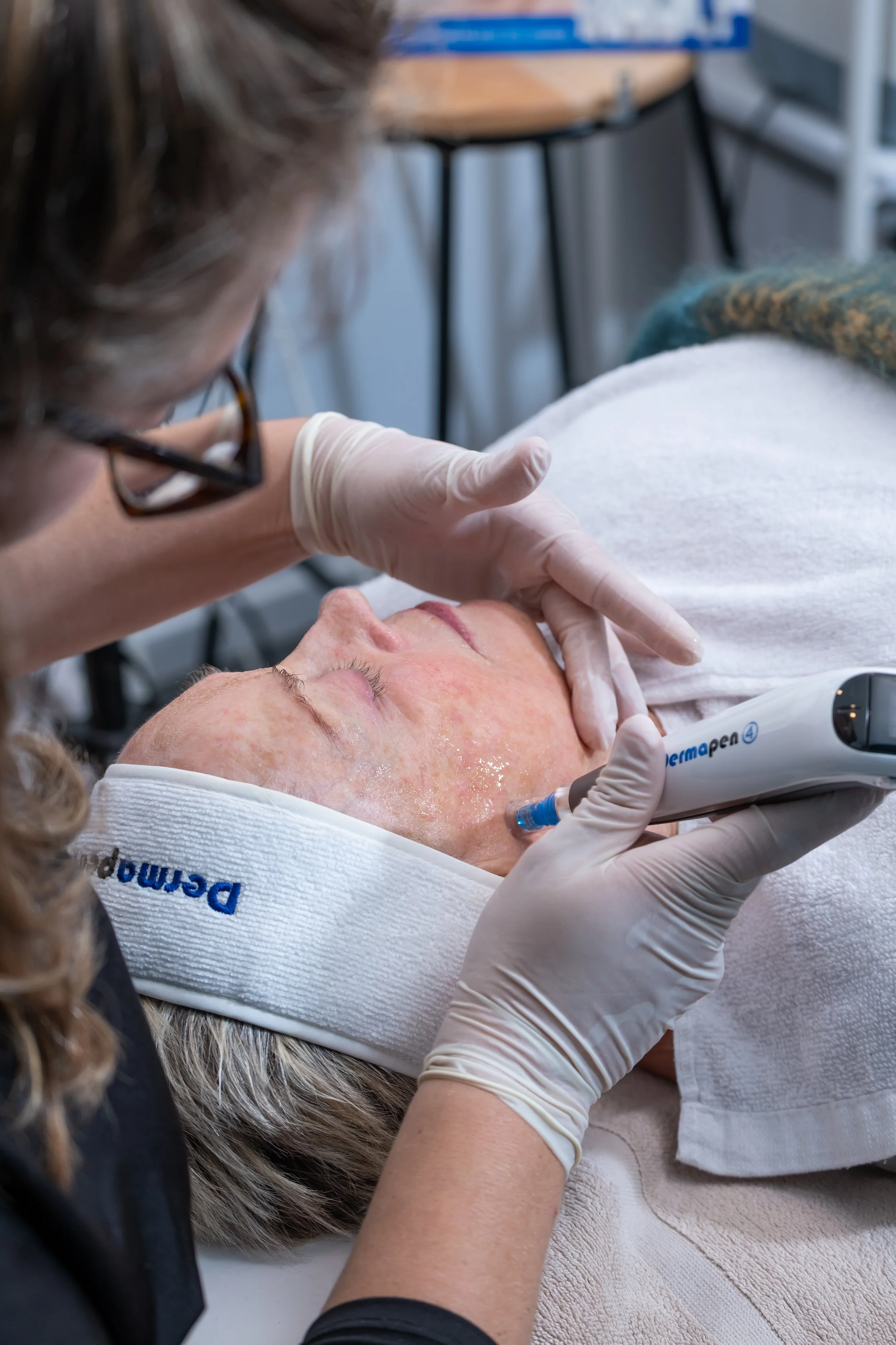 Sylvia and client using dermapen needling technique