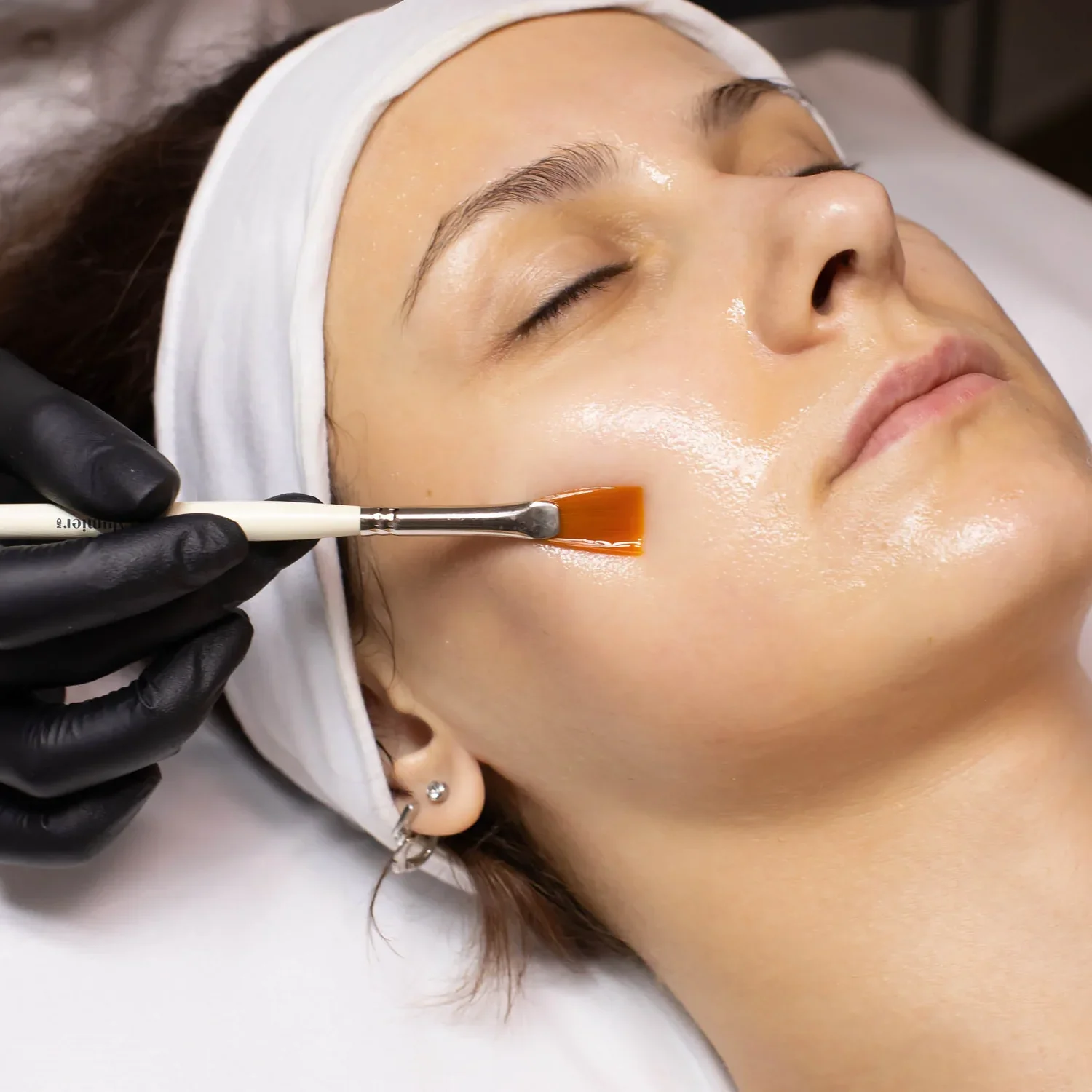 a professional alumiermd chemical peel treatment in progress