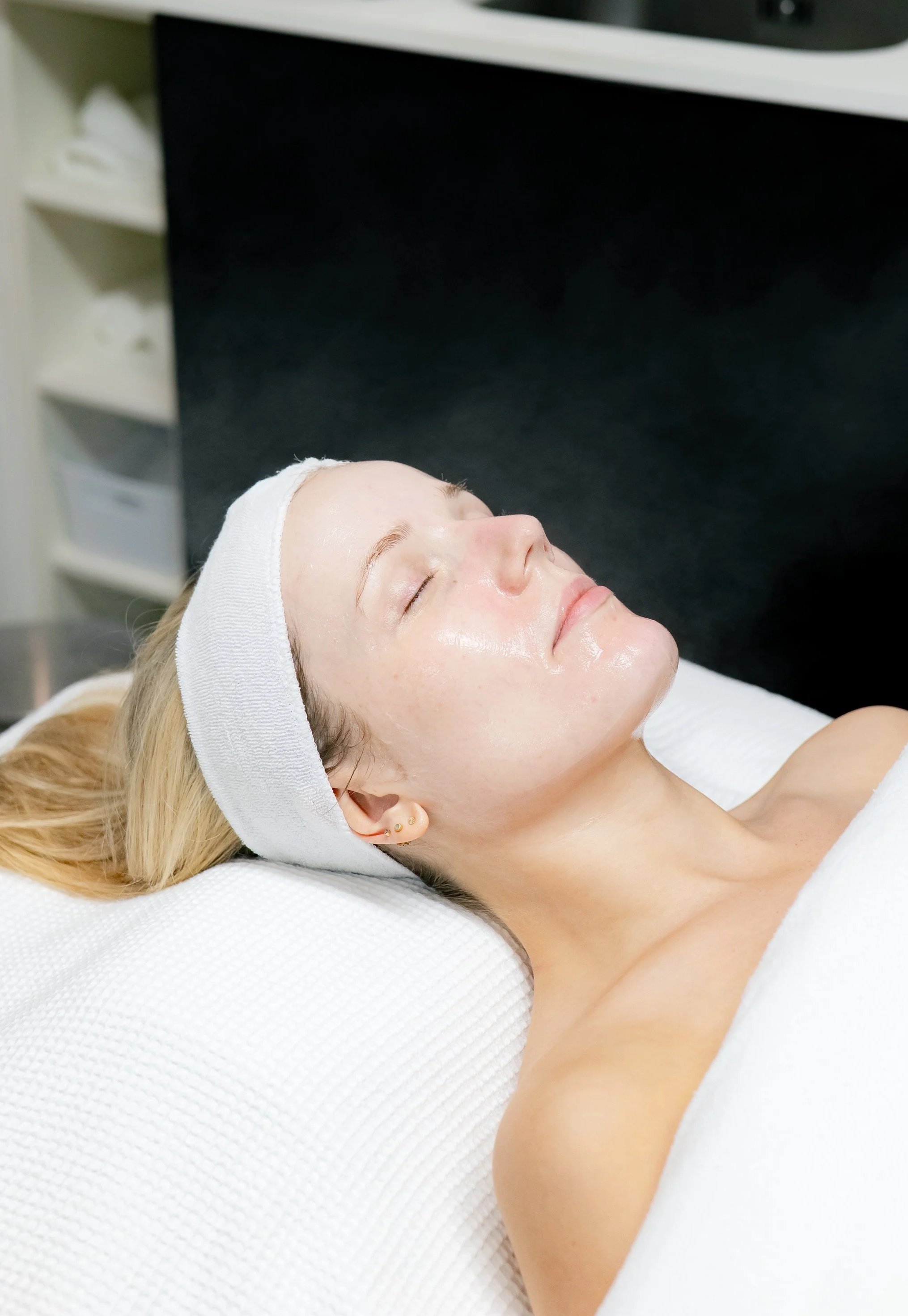 acne treatment consultation Gloucestershire in progress