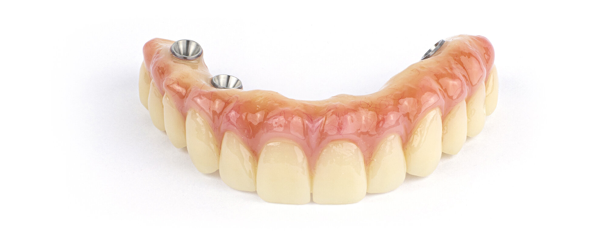 Nexus iOS - Digital Full-Arch Technology – Keystone Dental Group