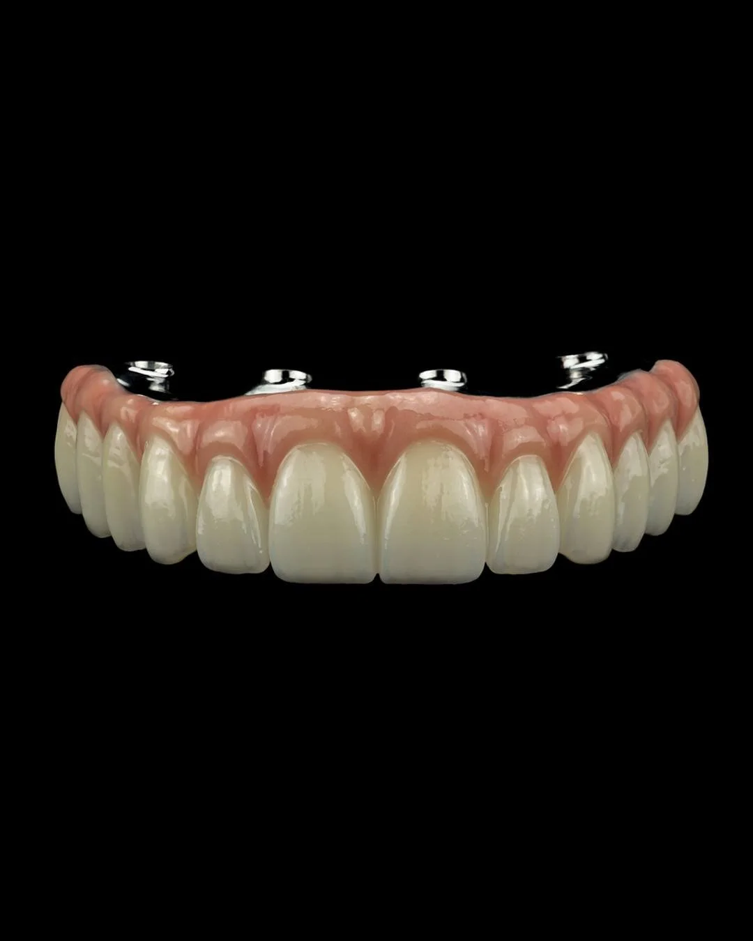 Today's case is a maxillary FP3 Nexus Hybrid case in monolithic zirconia, reinforced with lingual bulk and general material thickness to accomodate for clinician concerns of high bite force and some patient grinding. Balancing the midline, refining t