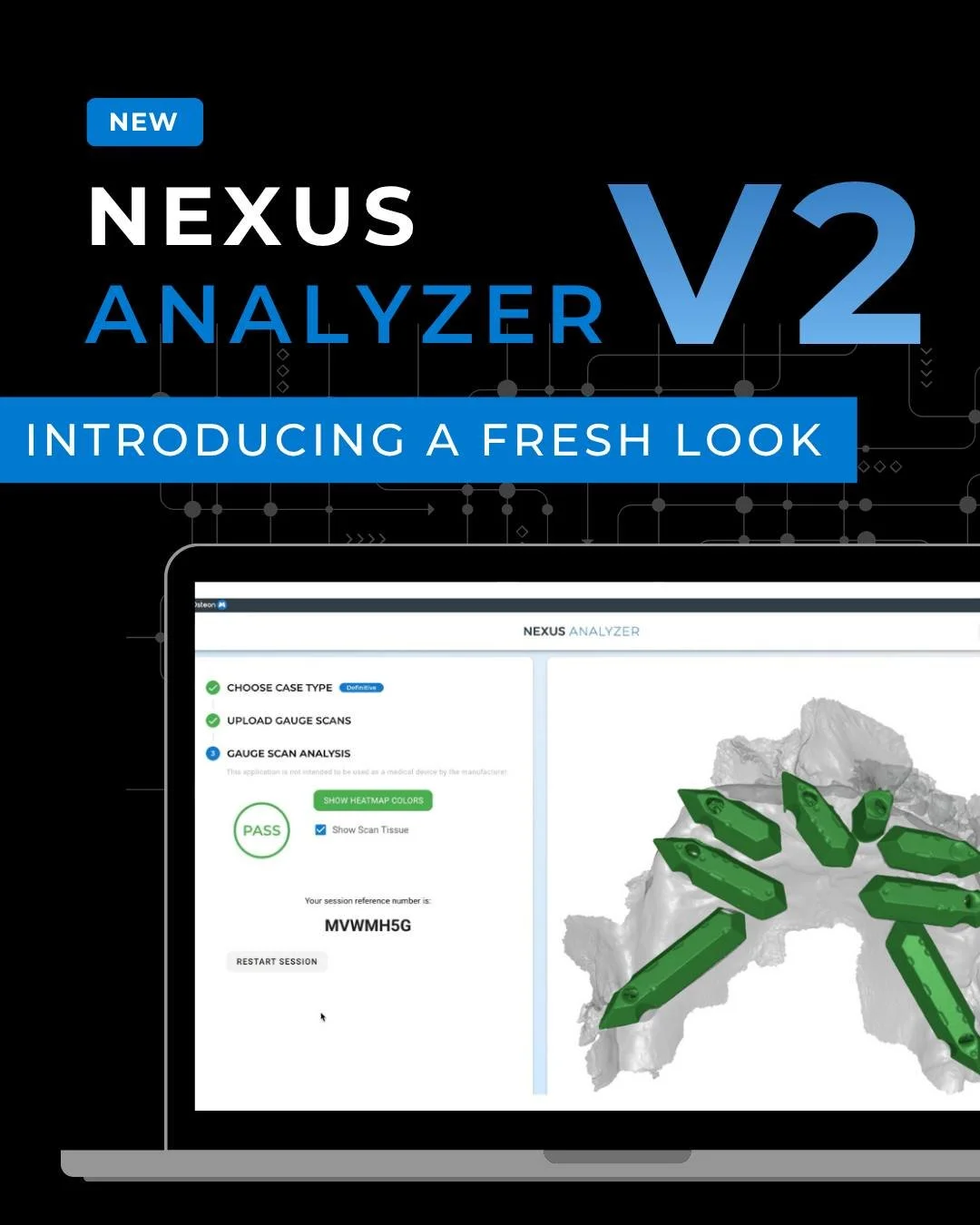 Nexus Analyzer v2 is now live. Enjoy a familiar workflow with a cleaner interface.
Check out the new analyzer via the Nexus iOS portal.