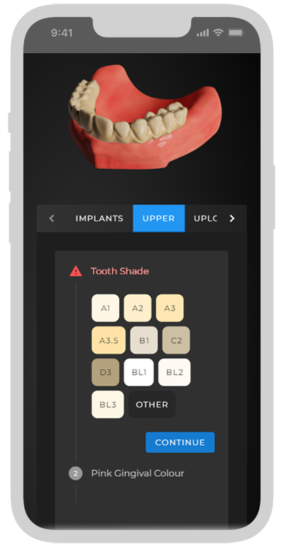 Nexus Scan Gauges and a validated intraoral scanner is all you need to  digitize your full-arch restoration workflow. When this data is…