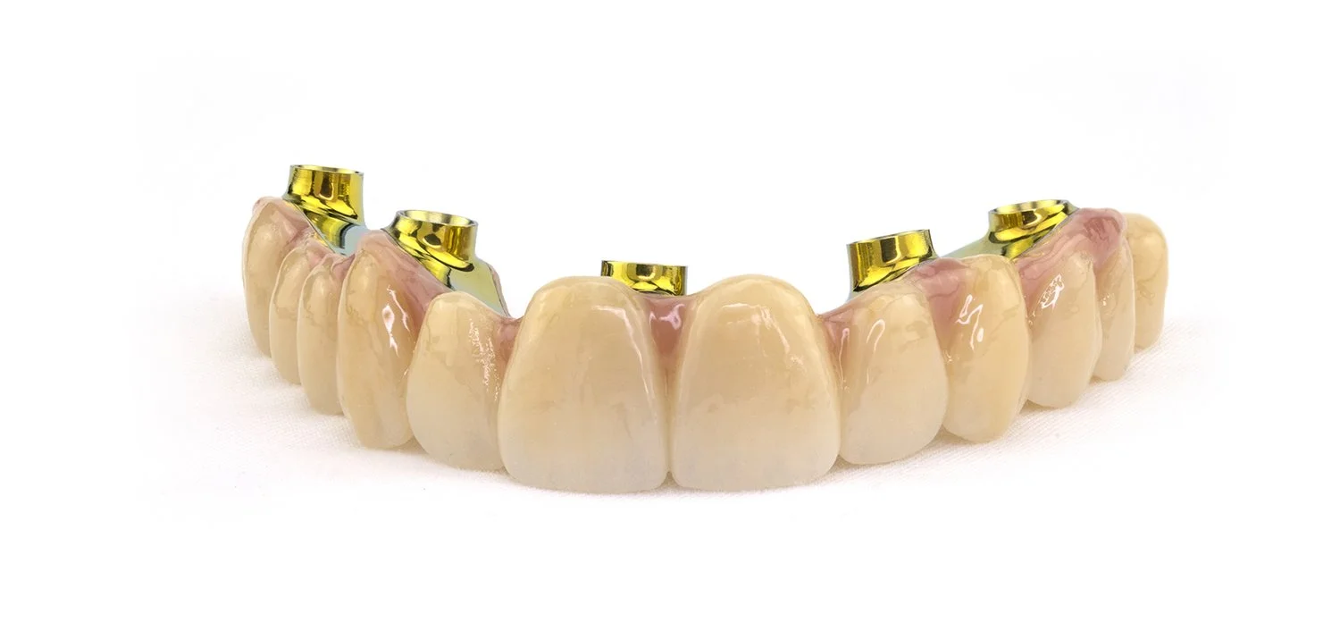 Nexus iOS Definitive Full-Arch Dental Prosthetics — Nexus iOS