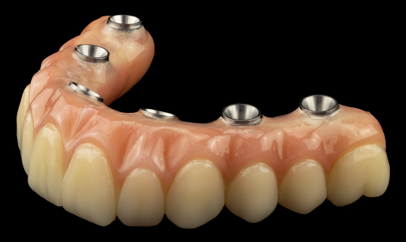 AurumTek® Implant Bridge powered by Nexus iOS - The Aurum Group