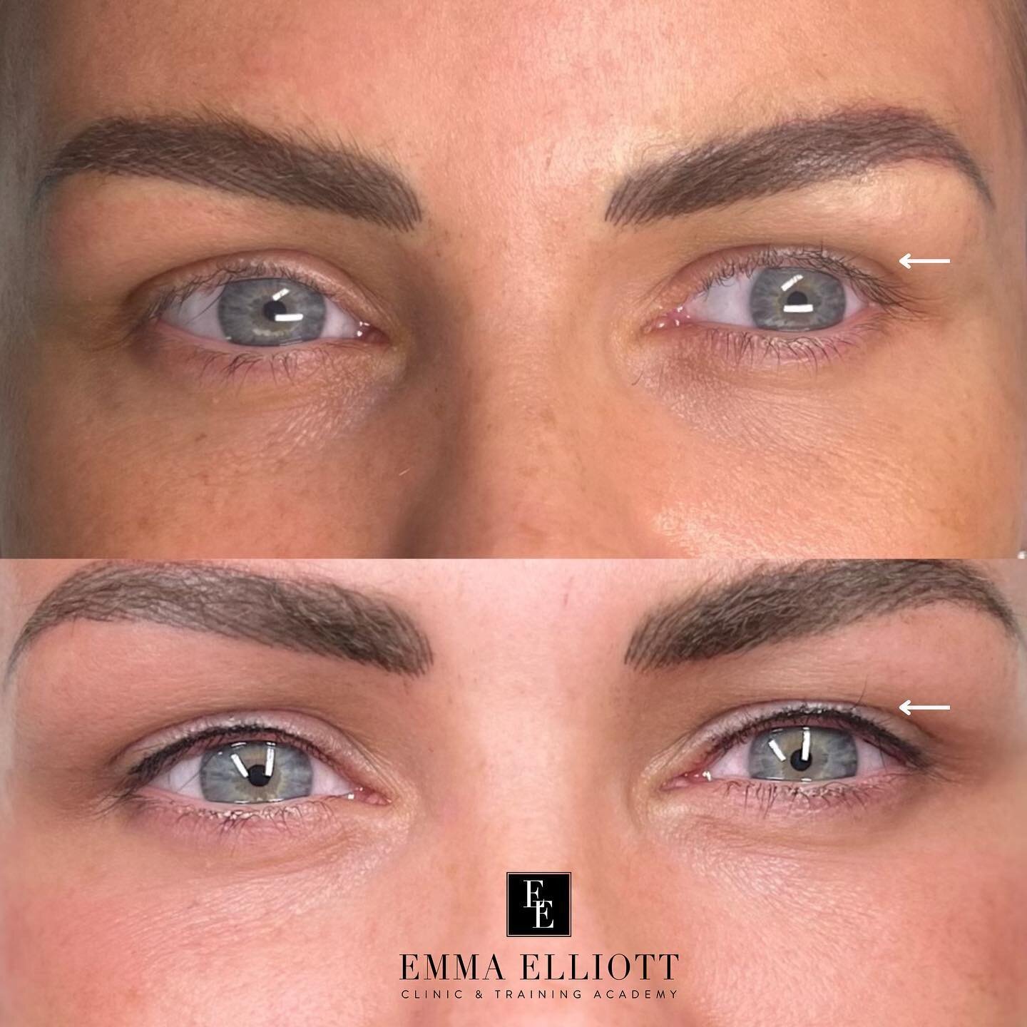 NOVEMBER EXCLUSIVE: &pound;50 OFF Lash Enhancement Bookings! 🖤💸

Discover the art of Lash Enhancement, a technique that offers the benefits of permanent eyeliner, defining your eyes and creates the illusion of fuller lashes. The result is a natural