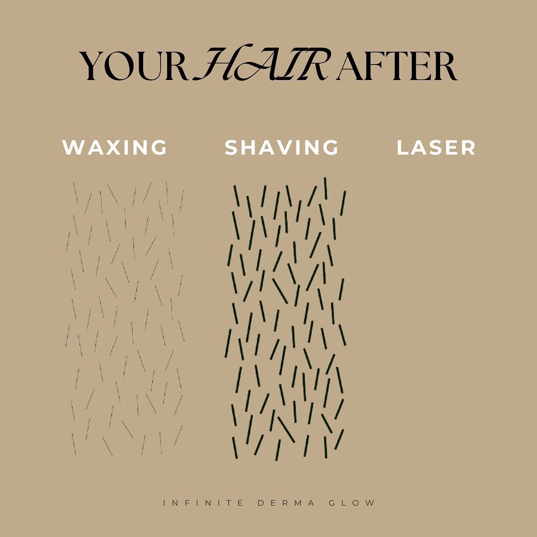 There is no denying it &ndash; laser treatments offer a higher guarantee of results. With shaving and waxing, you will have to engage in continued treatments at short intervals⚡️👏.

After the recommended number of treatments with laser, hair removal