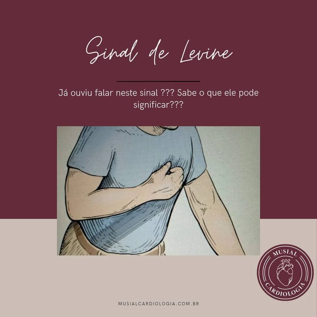 Voc&ecirc; conhece ou j&aacute; ouviu falar no sinal de Levine????

Quando o paciente apresenta um quadro de infarto agudo do mioc&aacute;rdio, muitas vezes ele coloca a m&atilde;o fechada apertando o peito devido &agrave; intensidade da dor. Este &e