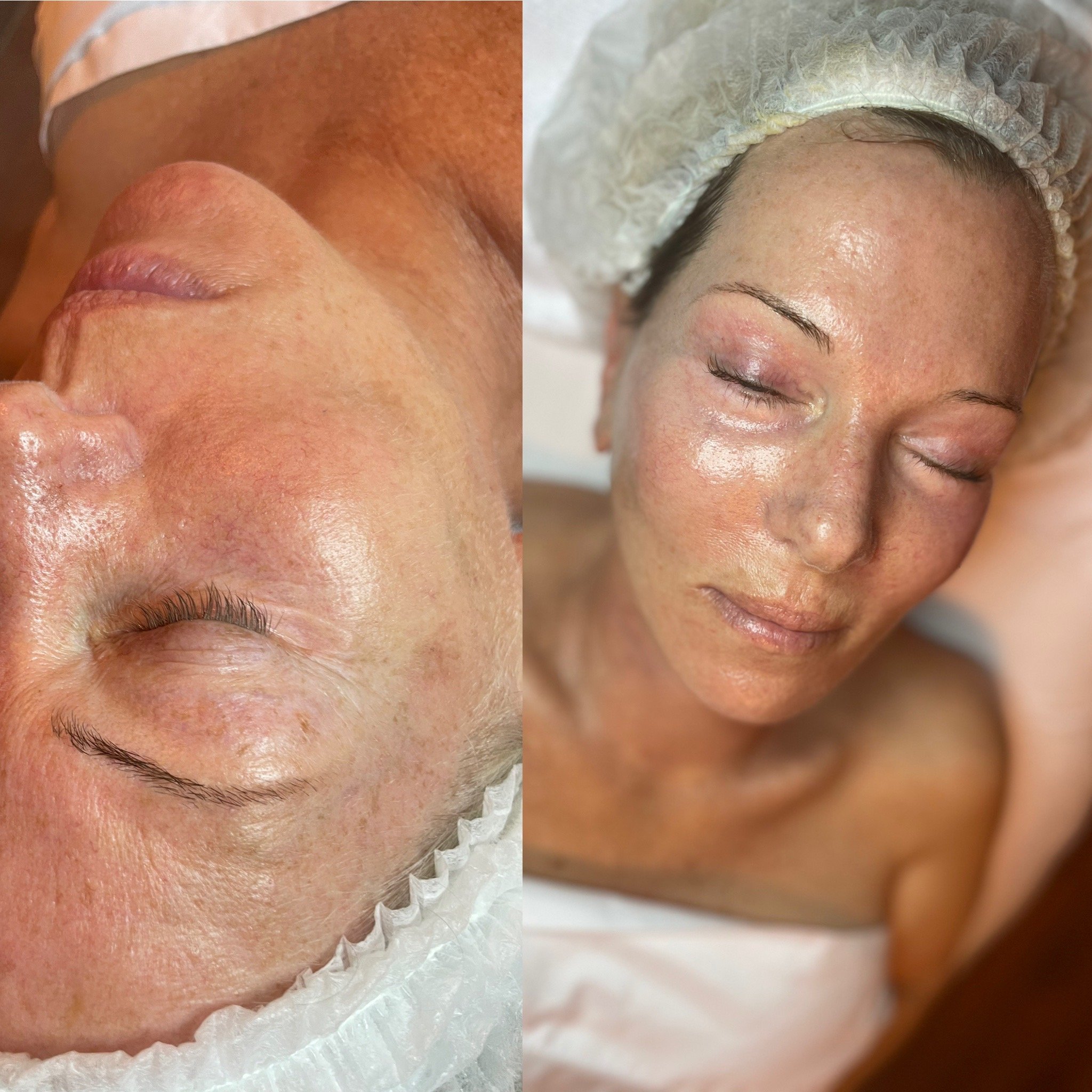 Anti-Aging Skincare Tips