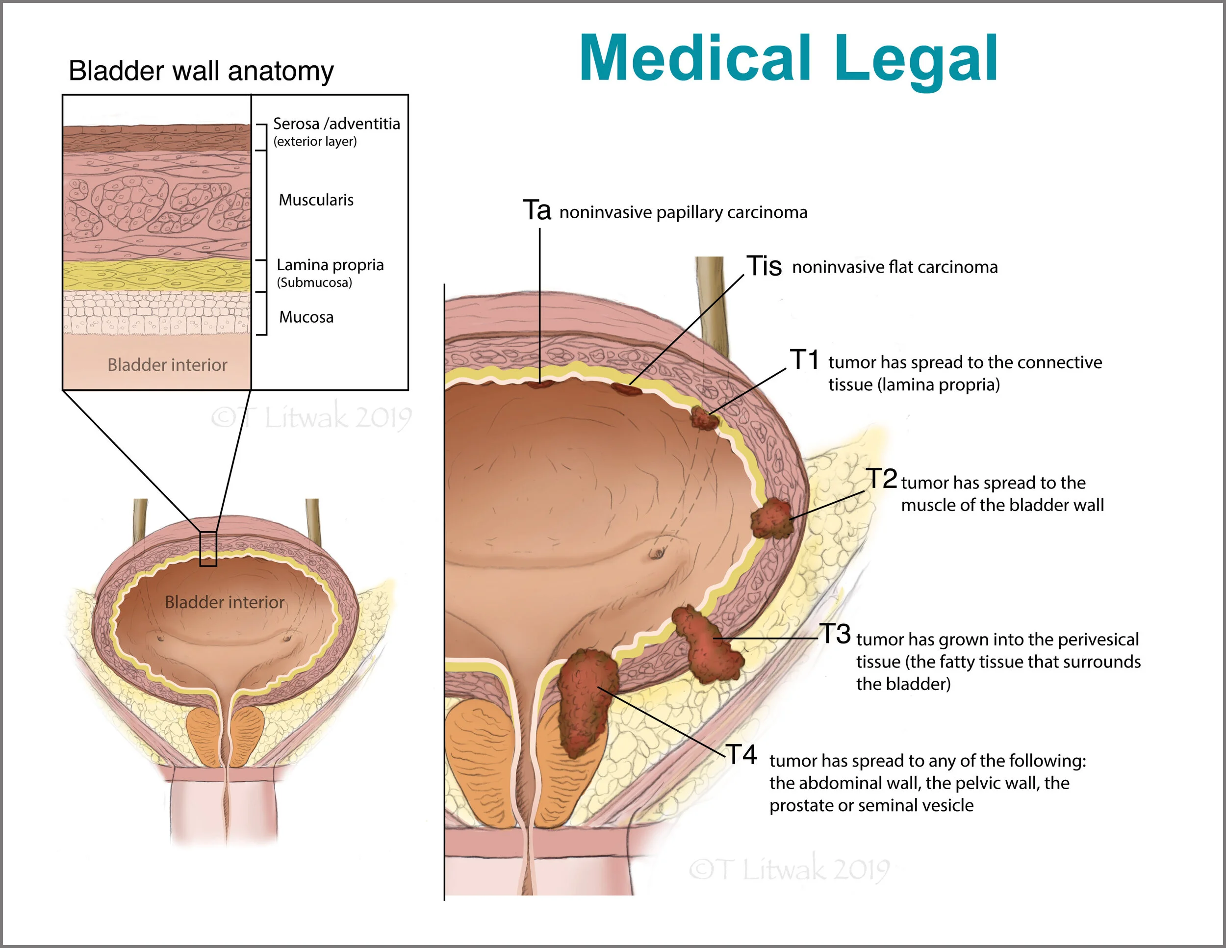 SECTION 3CannonBd2 Litwak.jpg