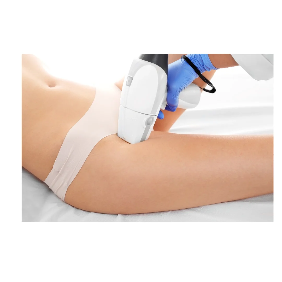 Women's full leg laser hair removal treatment Radiance Laser Cosmetics.webp