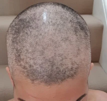 shaved head top.jpg