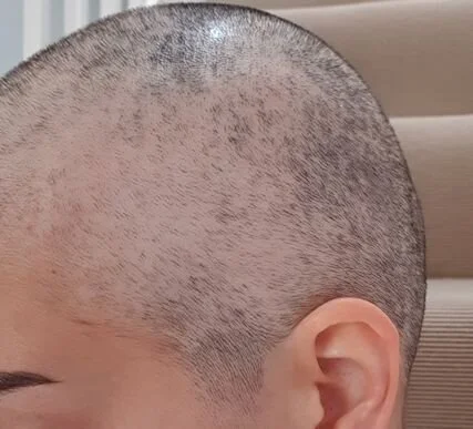 shaved head other side.jpg