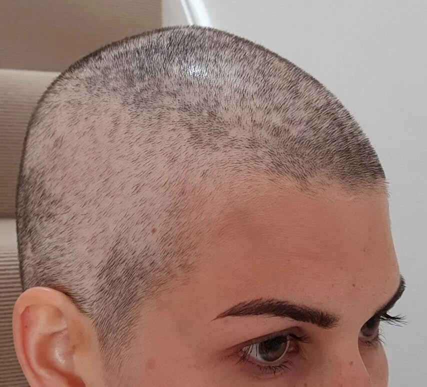 shaved head side.jpg