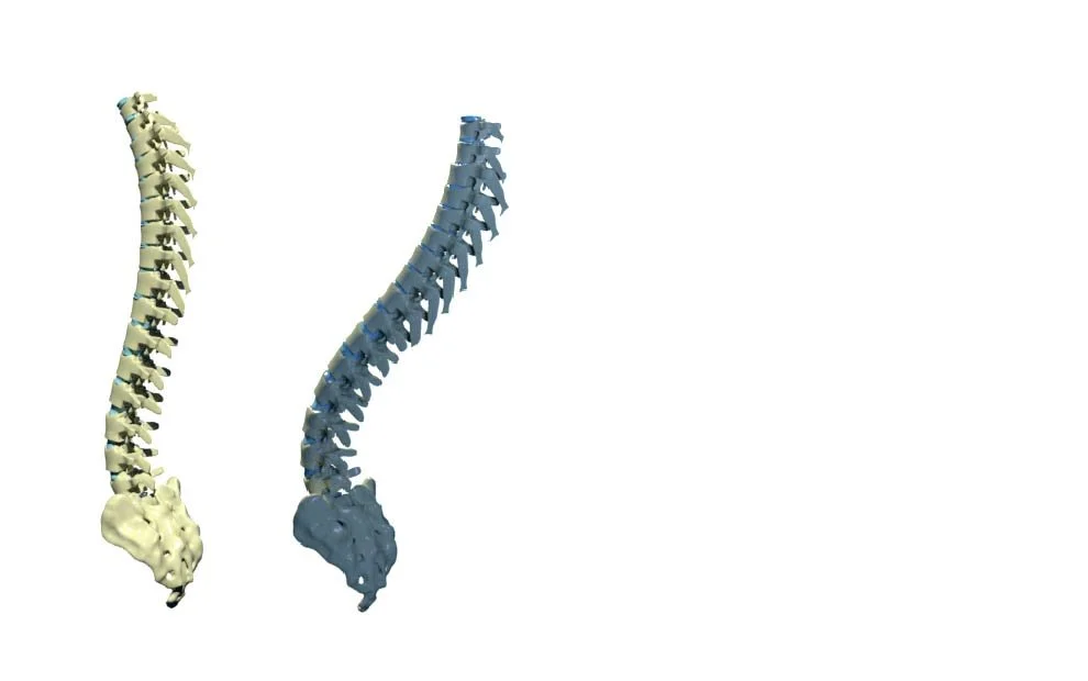 Extension and Flexion