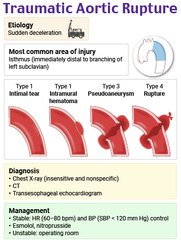 Image - Traumatic Aortic Rupture.png