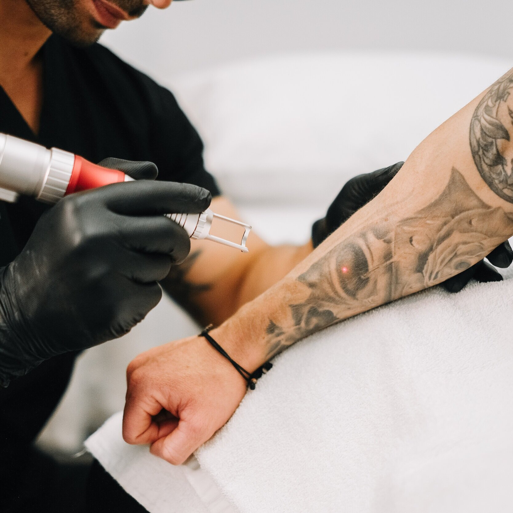 Rapid Laser Tattoo Removal  THE LASER DOCTOR