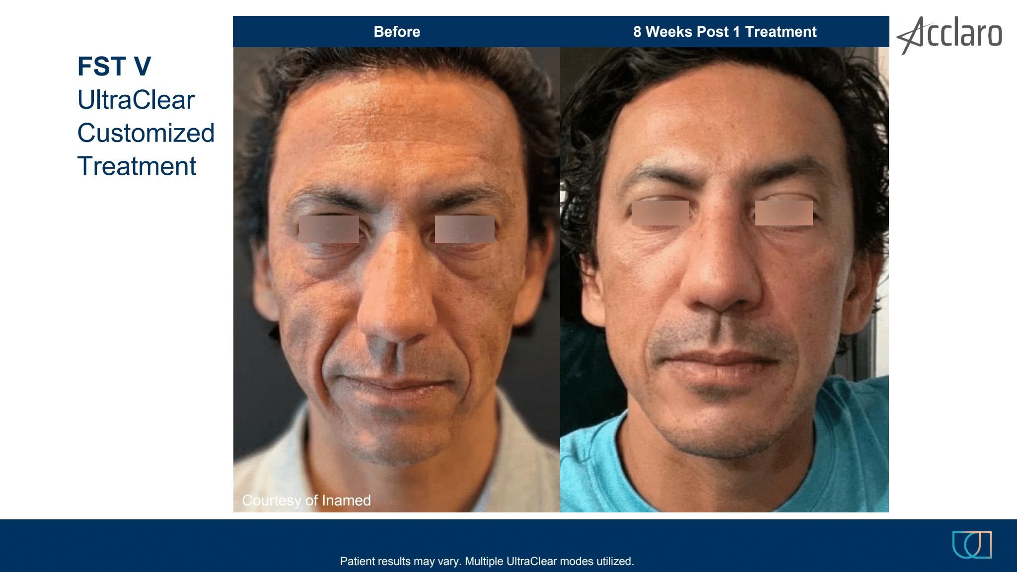 UltraClear® Laser Skin Rejuvenation — THE LASER DOCTOR