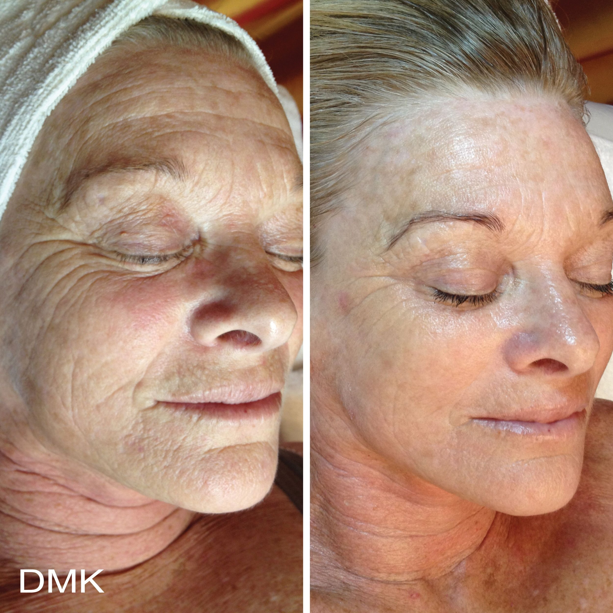 727450686MyDMKBrandedBeforeandAfterImageryAgeing1300dpi-large.jpg