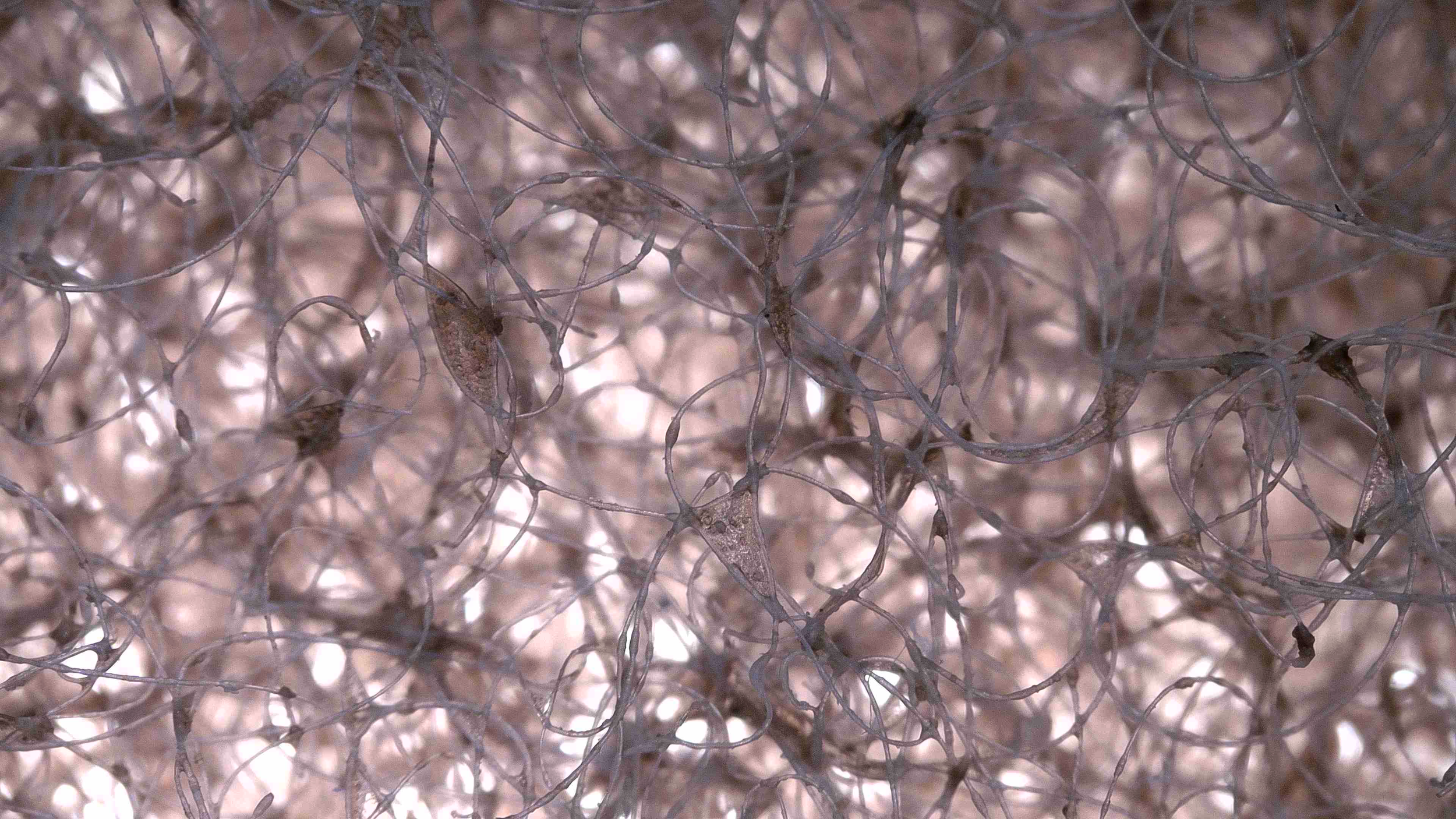 Close-up of tangled, thin, translucent materials with some darker, small dried fragments attached.