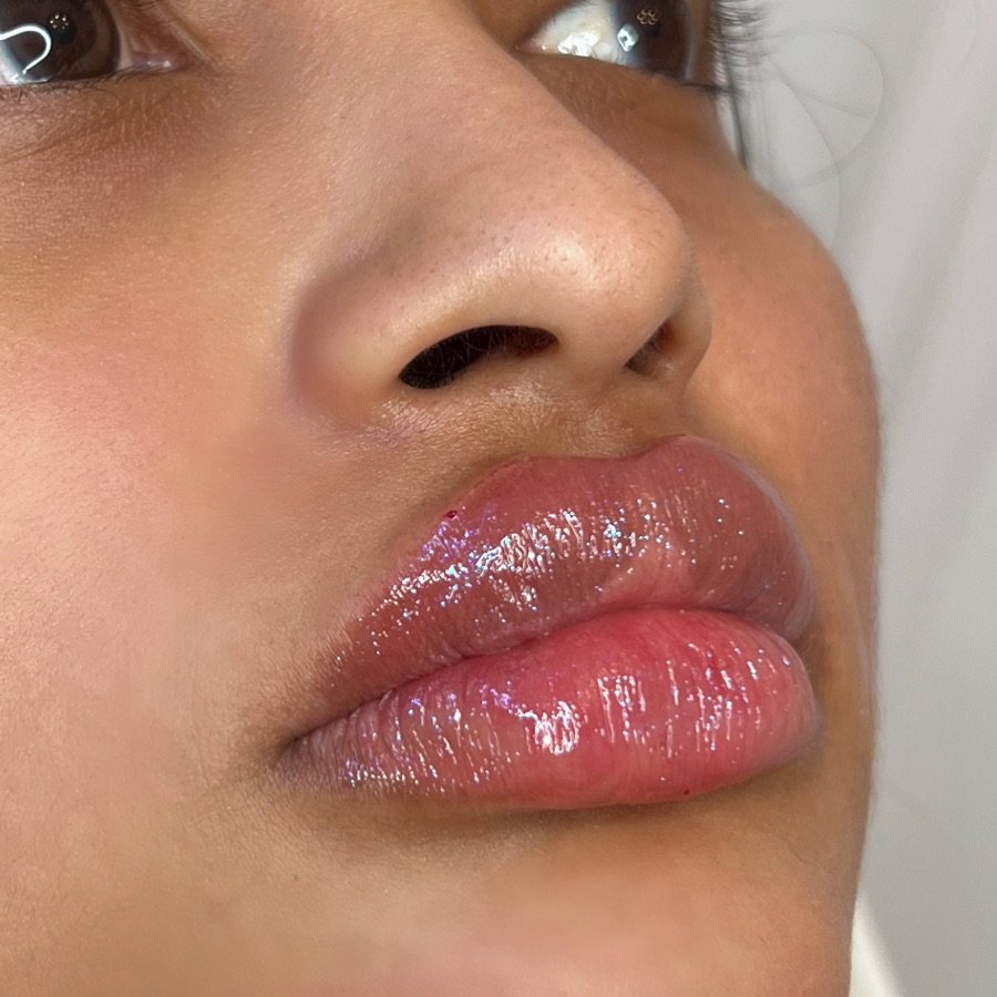 &bull; 

New year, same gorgeous lip technique 💋 👄 

To book your appointment, call, text or use the link in our bio! 

💉
Solange Medical Aesthetics
📍 Hamilton, Mississauga, Niagara, Bowmanville 🚧, London 🚧 &amp; Ottawa locations 
📱 289-244-84