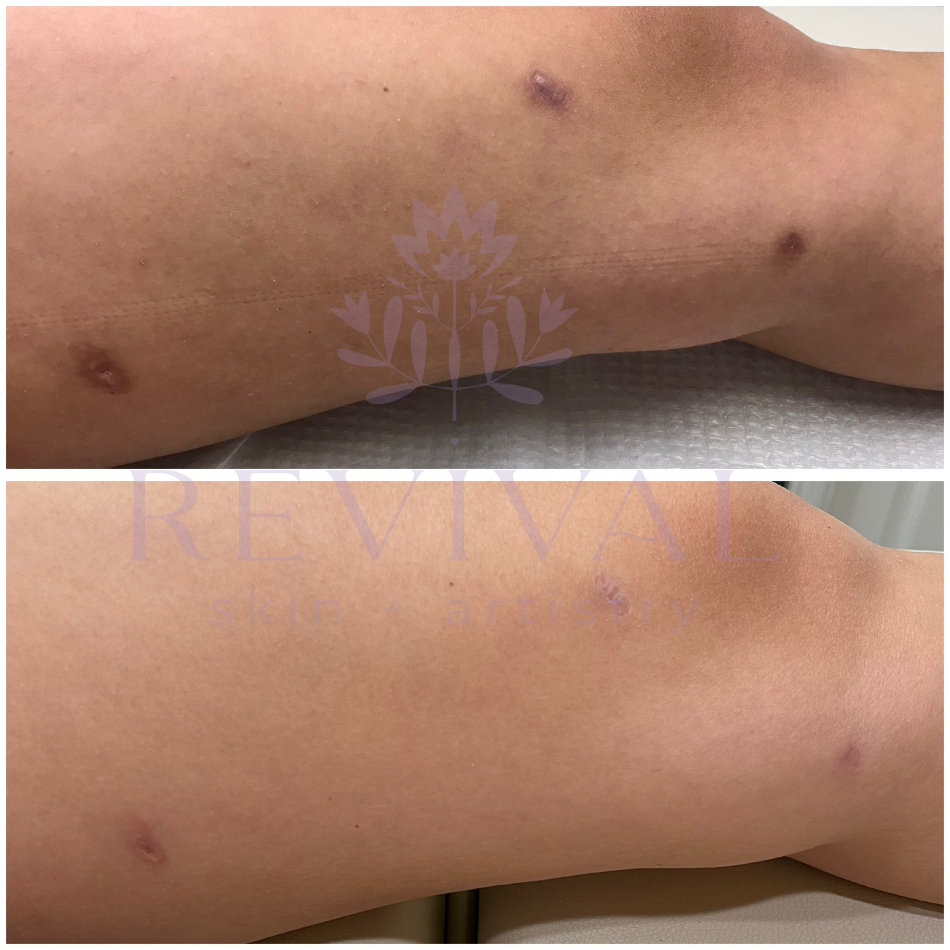 Untitled design 2.PNG