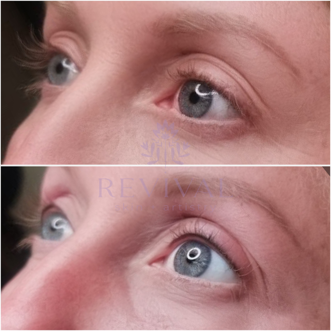Permanent eyeliner, lash enhancement