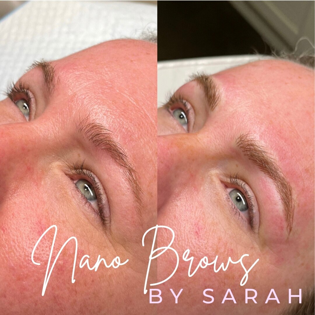 🧐Looking for a way to enhance your natural eyebrows? Consider Nano Brow Cosmetic Tattooing! 

⬇️READ BELOW ⬇️ 

This technique uses a super fine needle to create hair-like strokes that mimic your natural brow hairs, giving you a more defined and ful