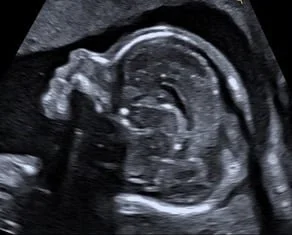  Gesichtsprofil 2D zur Feindiagnostik 