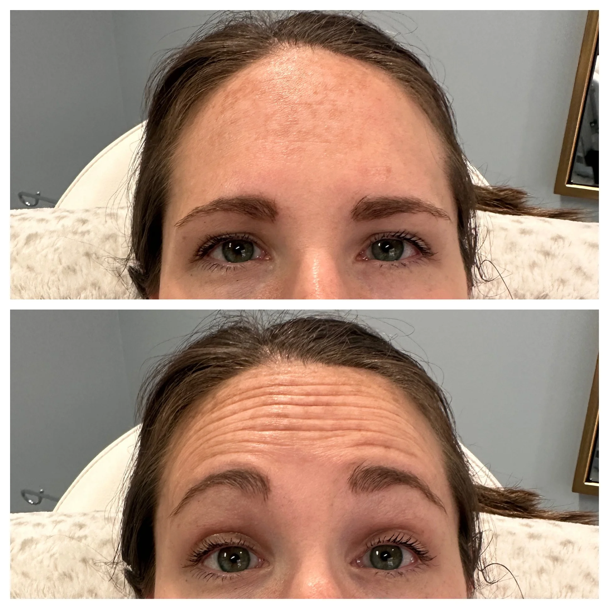 The Dreaded Heavy Brow: Why It Happens and How to Plan Around It